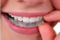 images_farrow_adult_braces