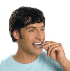 Man Invisalign Man Invisalign