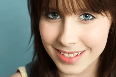 Clear Braces Center City PA