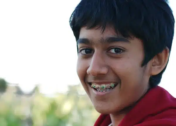 images_4047dc2f08c422a43c6430815243ead6 Fixing Crooked Teeth with Braces
