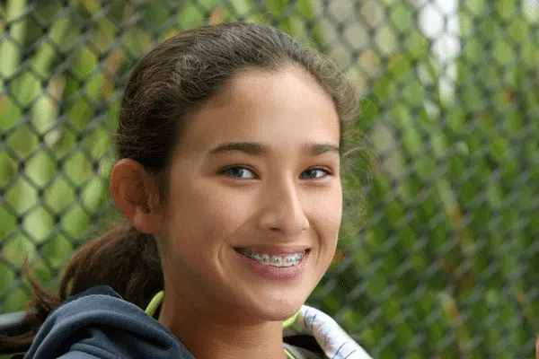 young-girl-with-braces-smiling young-girl-with-braces-smiling