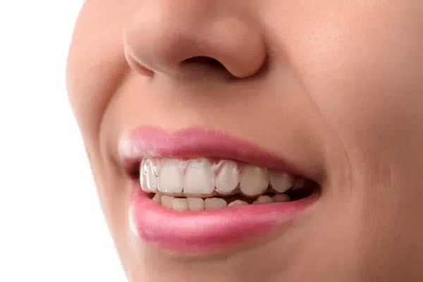 invisalign philadelphia county pa invisalign philadelphia county pa