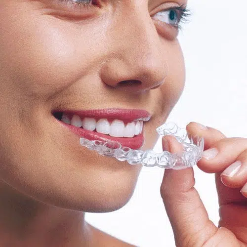 cost-of-invisalign-center-city-pa cost of invisalign center city pa