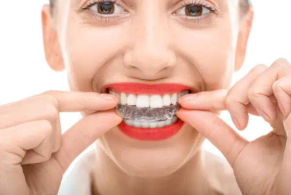 invisalign-clear-aligners-everything-you-need-to-know-philadelphia-pa