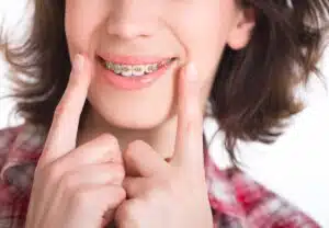 Tips for Braces During a Quarantine