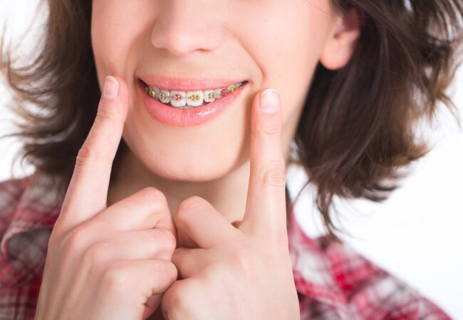 Tips for Braces During a Quarantine