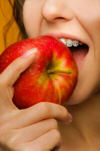 Foods To Avoid This Holiday Season With Braces