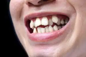 orthodontic problems and solutions Philadelphia