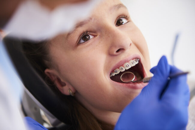 Orthodontic Care for Kids and Teens