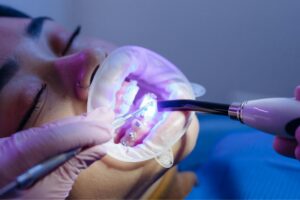 Orthodontic Treatment and Sleep Apnea