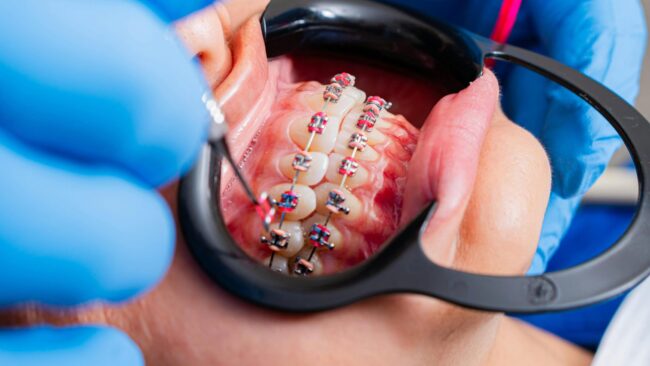 AI in orthodontics