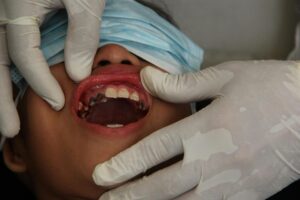 Smile Makeover Dentist: Proven Steps to Transform Your Smile