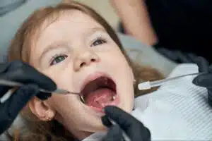 Benefits of Early Orthodontic Treatment